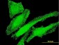 ITGB7 Antibody (monoclonal) (M01)